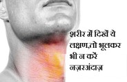 Throat Cancer