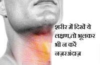 Throat Cancer