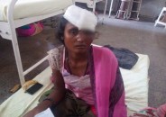 Injured women