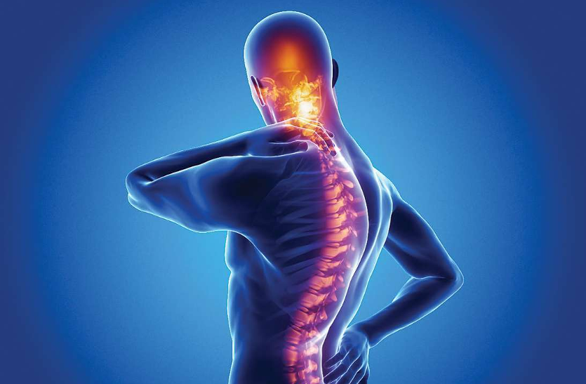 spondylitis-diseases-and-its-cure
