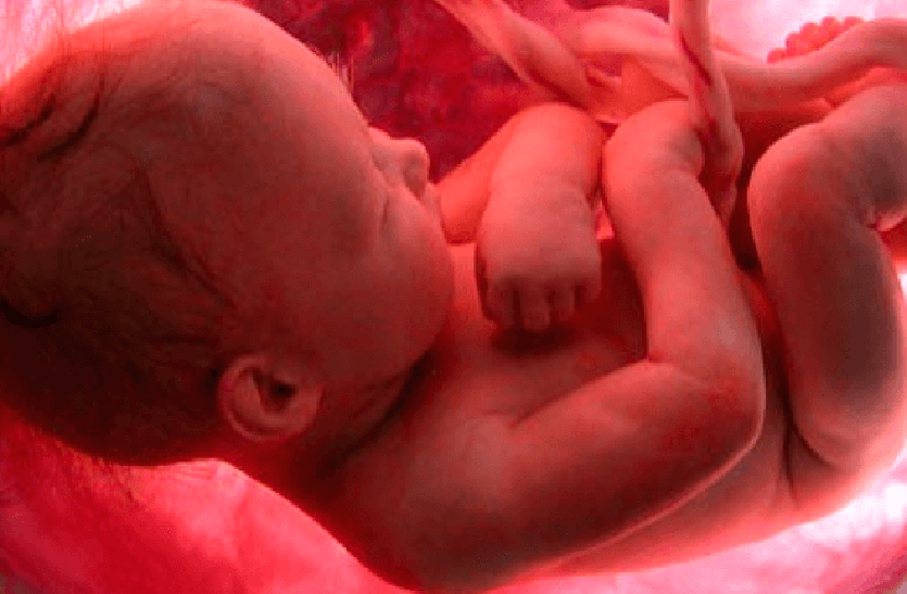 fetus Death