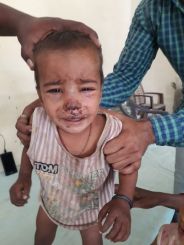 Step father beat children