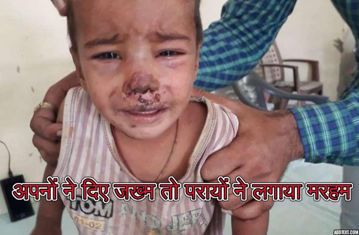 step father beaten children