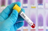 zika