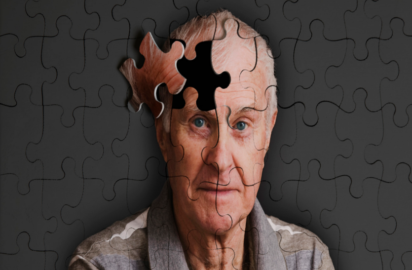 ayurvedic-prescriptions-are-effective-in-the-treatment-of-alzheimer-s
