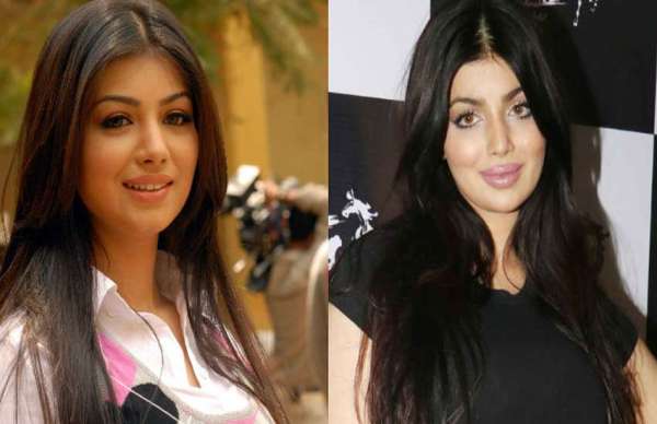 ayesha takia latest photos fans did not recognize her after surgery
