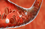Bleeding Disorders