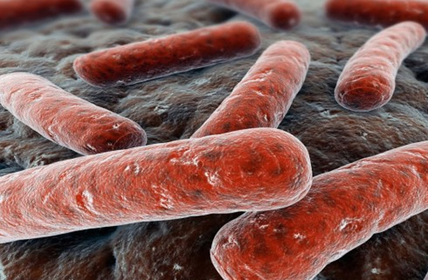 tuberculosis patient