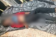Dead body