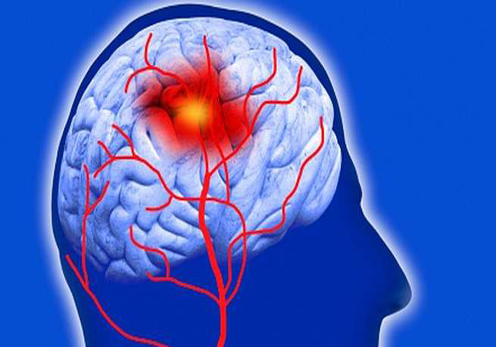 world stroke day special story