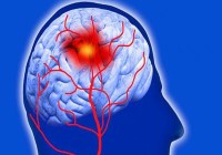 world stroke day special story