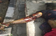 Identify of lady's dead body