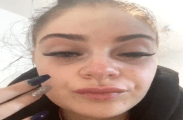 omg