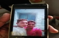 husband burned his wife, situation serious