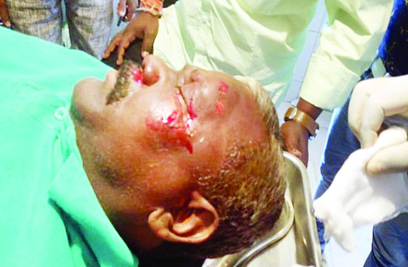 सड़क पर पड़े गिट्टी से स्लिप होकर गिरे विधायक प्रत्याशी, चेहरे पर आई गंभीर चोट