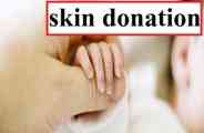 skin donation