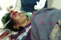 Breaking : दशगात्र में शामिल होने जा रहे ग्रामीणों से भरी पिकअप पेड़ से टकराई, 12 घायल