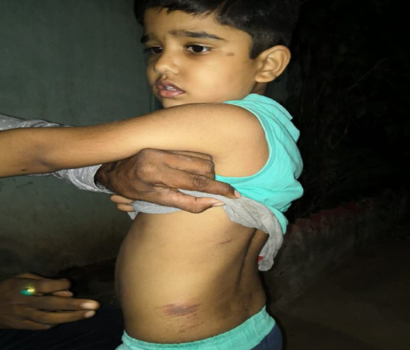 अंडरवियर खरीदने के बहाने बसपा नेता व व्यवसायी के मासूम बेटे का बलपूर्वक अपहरण की कोशिश, लोगों ने दौड़ाया तो मासूम को फेंक कर भागे