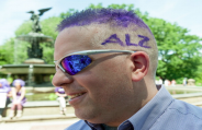 Alzheimer