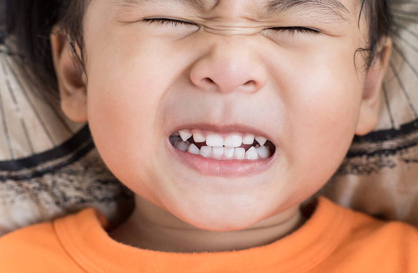 if-your-child-grinds-teeth-learn-about-the-cause-and-treatment