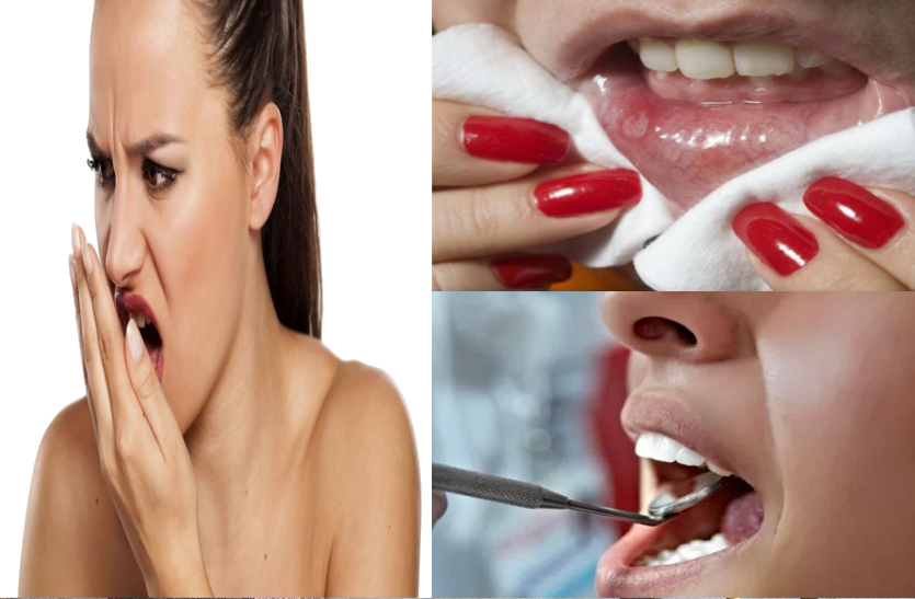 this-home-remedies-beneficial-for-mouth-odor-ulcers-and-teeth