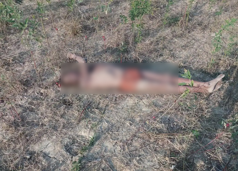 Dead body
