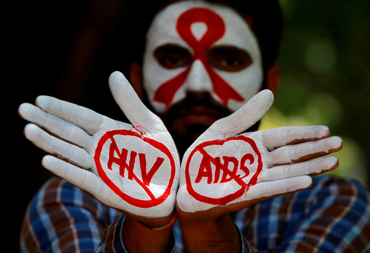 HIV AIDS