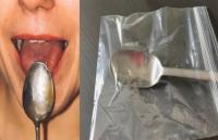 spoon test