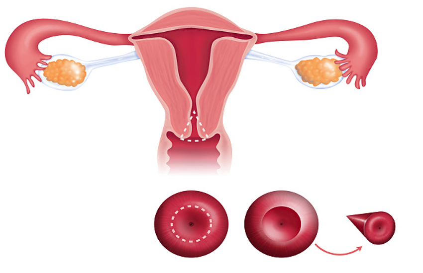 women's health