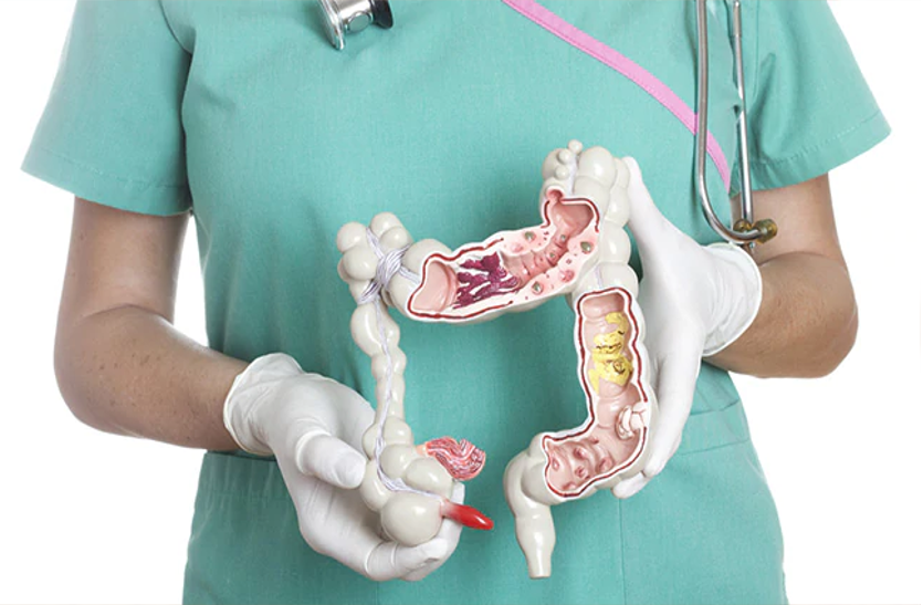 do-these-methods-to-clean-the-intestines