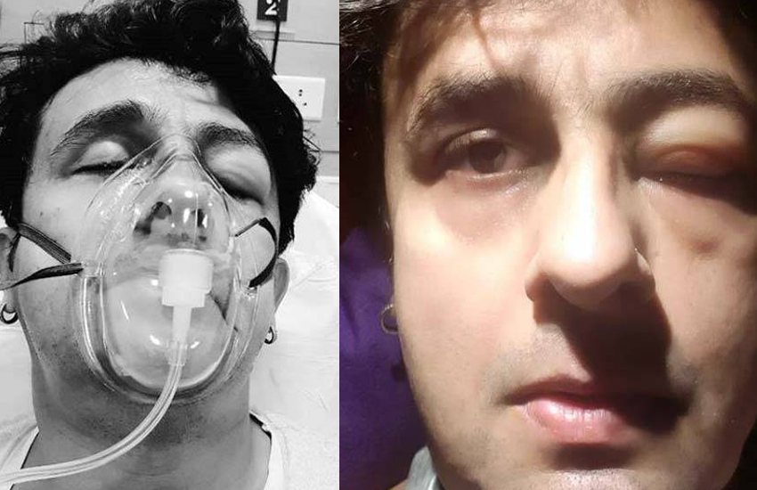 sonu nigam rushed into the icu of a hospital share photos