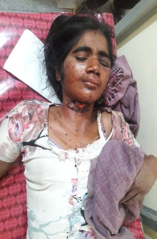 Wounded woman
