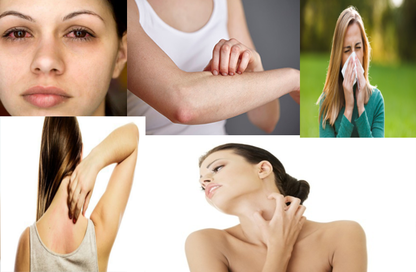allergy-is-also-caused-by-weak-immunity