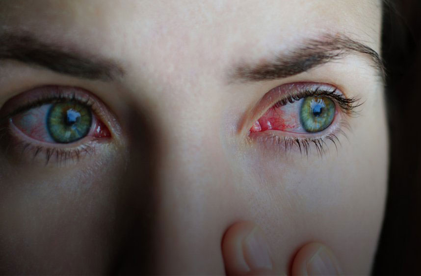 take-care-of-the-eyes