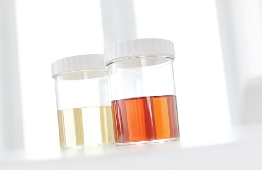 urine color