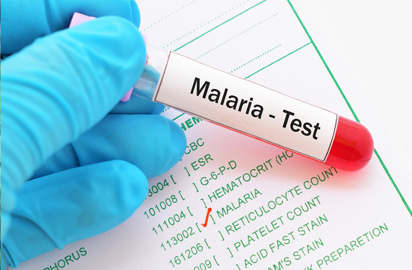 learn-about-treating-malaria-these-tips-are-beneficial