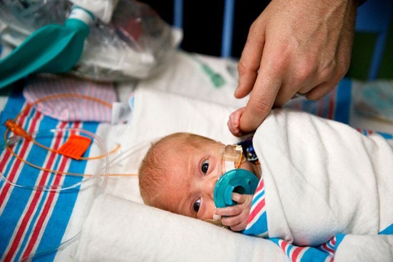 listen-to-unusual-sounds-by-new-born-baby-for-disease-alert