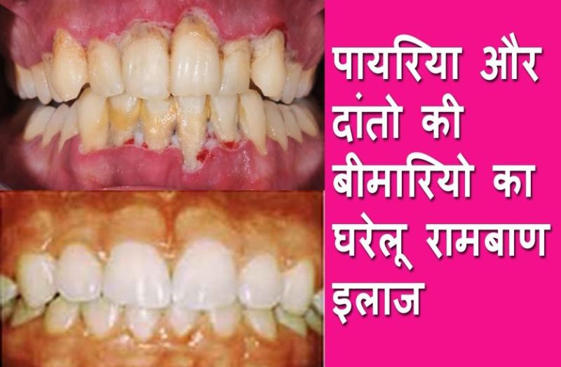 payiriya our muh ki badbu