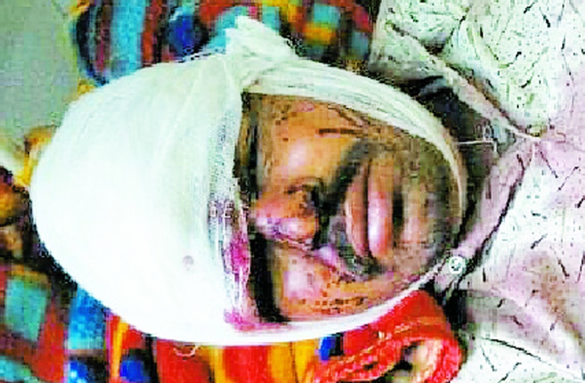 , Bear attack on farmer