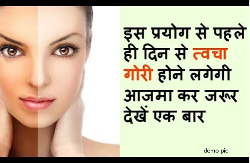 गोरा होने के घरेलू उपाय | Gora Hone Ka Tarika In Hindi | Tips For Glowing Skin 