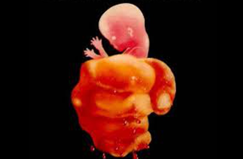 Female feticide
