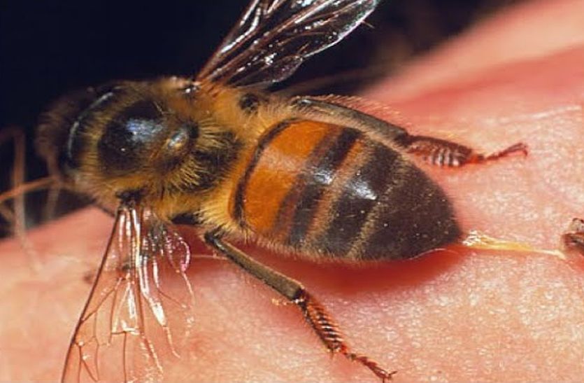 Honeybies bite groom and bridgroom