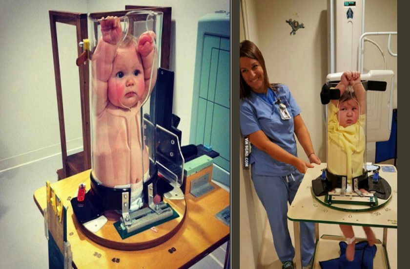 Pigg O Stat method of X ray of babies photos went viral