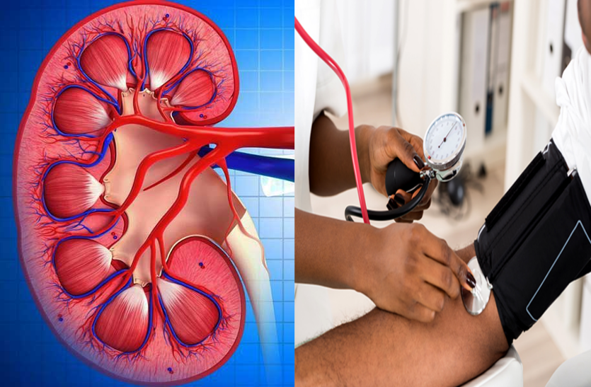 if-there-is-high-bp-then-kidney-problem-may-occur
