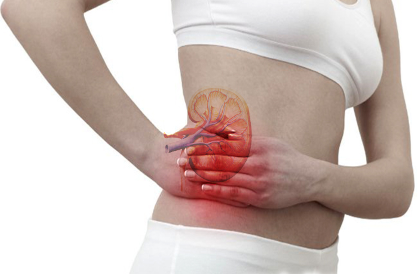 home-remedies-for-kidney-stones-treatment