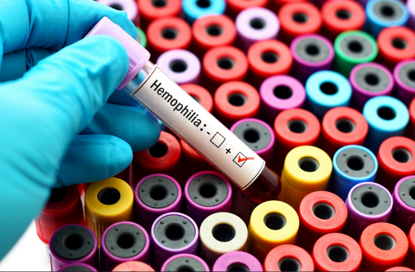 hemophilia-problem-is-caused-by-genetic-factors
