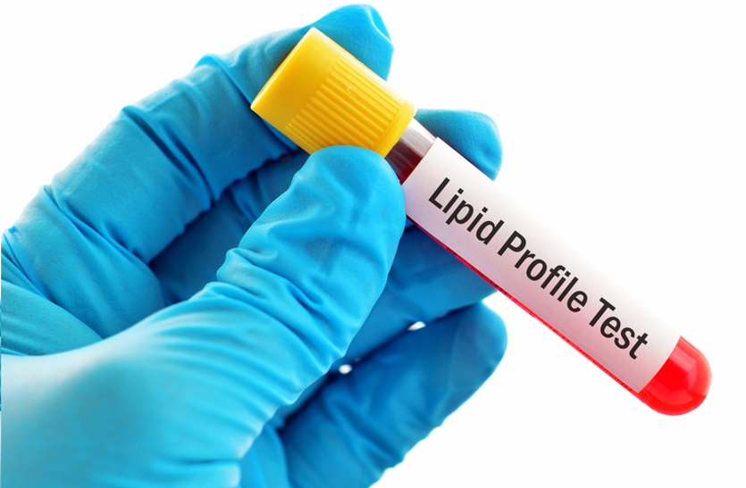 know-about-lipid-profile-test