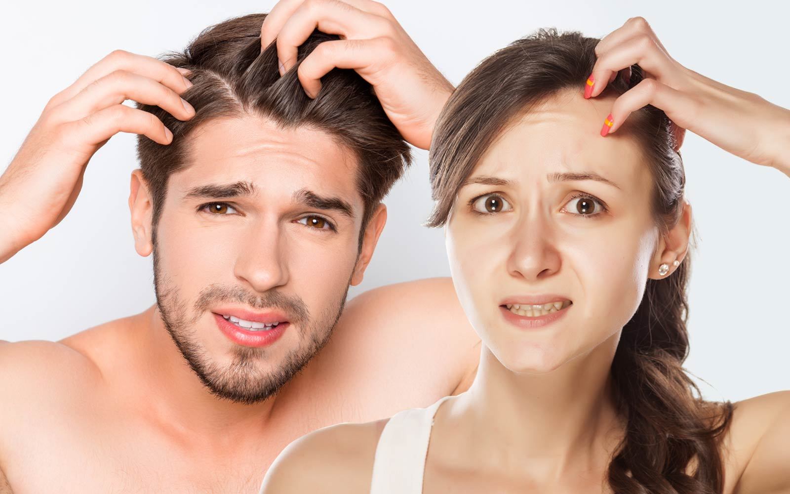 hair problems man and women
