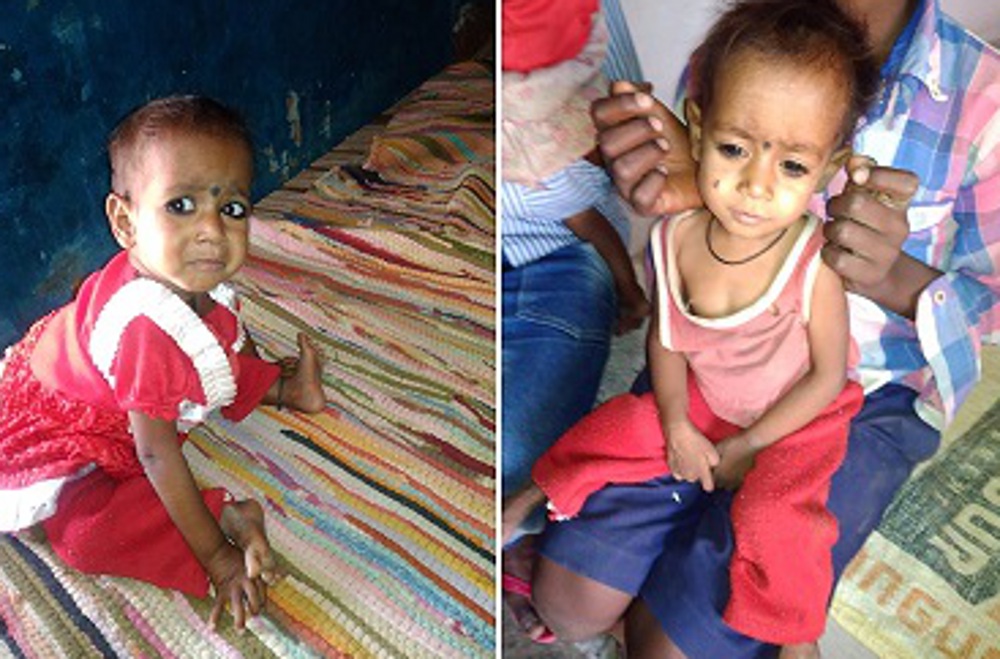 CM Helpline for malnourished children