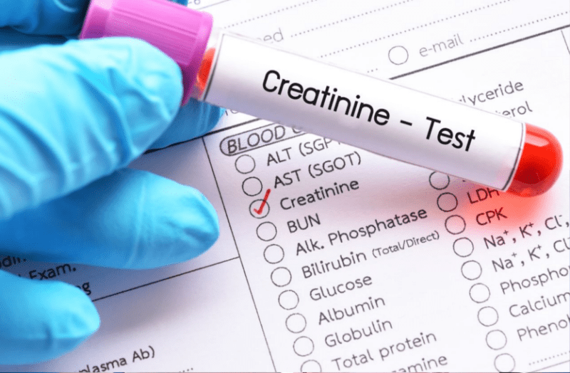 can-learn-about-kidney-function-from-creatinine-test